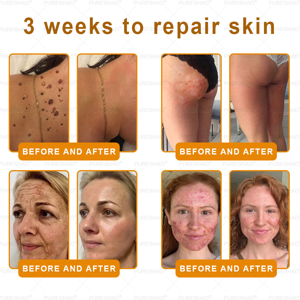 𝐌𝐚𝐝𝐞 𝐚𝐧𝐝 𝐒𝐡𝐢𝐩𝐩𝐞𝐝 𝐟𝐫𝐨𝐦 𝐔𝐒𝐀 ✨𝗣𝘂𝗿𝗲𝐒𝐡𝐚𝐝𝐞® 𝐍𝐞𝐜𝐤 & 𝐂𝐡𝐞𝐬𝐭 𝐅𝐢𝐫𝐦𝐢𝐧𝐠 𝐀𝐠𝐞 𝐑𝐞𝐧𝐞𝐰 𝐂𝐫𝐞𝐚𝐦