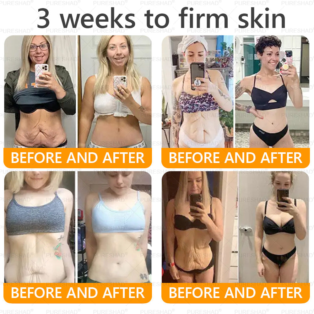 𝐌𝐚𝐝𝐞 𝐚𝐧𝐝 𝐒𝐡𝐢𝐩𝐩𝐞𝐝 𝐟𝐫𝐨𝐦 𝐔𝐒𝐀 ✨𝗣𝘂𝗿𝗲𝐒𝐡𝐚𝐝𝐞® 𝐍𝐞𝐜𝐤 & 𝐂𝐡𝐞𝐬𝐭 𝐅𝐢𝐫𝐦𝐢𝐧𝐠 𝐀𝐠𝐞 𝐑𝐞𝐧𝐞𝐰 𝐂𝐫𝐞𝐚𝐦