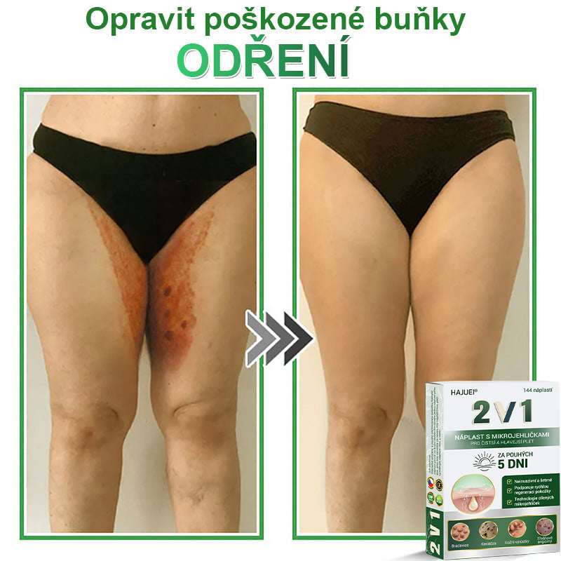 HAJUEI® 📌 𝟐𝐯𝟏 𝐡𝐲𝐝𝐫𝐨𝐤𝐨𝐥𝐨𝐢𝐝𝐧í 𝐧á𝐩𝐥𝐚𝐬𝐭𝐢 𝐬 𝐦𝐢𝐤𝐫𝐨𝐣𝐞𝐡𝐥𝐢č𝐤𝐚𝐦𝐢 | 𝐒𝐩𝐞𝐜𝐢á𝐥𝐧ě 𝐯𝐲𝐯𝐢𝐧𝐮𝐭é 𝐩𝐫𝐨 𝐨𝐝𝐬𝐭𝐫𝐚𝐧ě𝐧í 𝐯𝐲𝐬𝐭𝐨𝐮𝐩𝐥ý𝐜𝐡 𝐦𝐚𝐭𝐞ř𝐬𝐤ý𝐜𝐡 𝐳𝐧𝐚𝐦é𝐧𝐞𝐤, 𝐚𝐤𝐧é, 𝐩𝐥𝐨𝐜𝐡ý𝐜𝐡 𝐛𝐫𝐚𝐝𝐚𝐯𝐢𝐜 𝐚 𝐤𝐨ž𝐧í𝐜𝐡 𝐯ý𝐫ů𝐬𝐭𝐤ů | 𝐁𝐚𝐥𝐞𝐧í 𝟏𝟒𝟒 𝐤𝐮𝐬ů🌵🌵