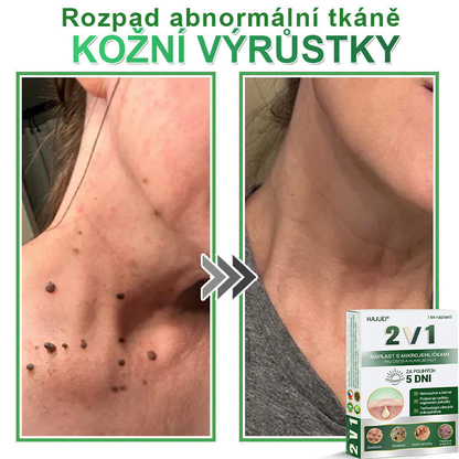 HAJUEI® 📌 𝟐𝐯𝟏 𝐡𝐲𝐝𝐫𝐨𝐤𝐨𝐥𝐨𝐢𝐝𝐧í 𝐧á𝐩𝐥𝐚𝐬𝐭𝐢 𝐬 𝐦𝐢𝐤𝐫𝐨𝐣𝐞𝐡𝐥𝐢č𝐤𝐚𝐦𝐢 | 𝐒𝐩𝐞𝐜𝐢á𝐥𝐧ě 𝐯𝐲𝐯𝐢𝐧𝐮𝐭é 𝐩𝐫𝐨 𝐨𝐝𝐬𝐭𝐫𝐚𝐧ě𝐧í 𝐯𝐲𝐬𝐭𝐨𝐮𝐩𝐥ý𝐜𝐡 𝐦𝐚𝐭𝐞ř𝐬𝐤ý𝐜𝐡 𝐳𝐧𝐚𝐦é𝐧𝐞𝐤, 𝐚𝐤𝐧é, 𝐩𝐥𝐨𝐜𝐡ý𝐜𝐡 𝐛𝐫𝐚𝐝𝐚𝐯𝐢𝐜 𝐚 𝐤𝐨ž𝐧í𝐜𝐡 𝐯ý𝐫ů𝐬𝐭𝐤ů | 𝐁𝐚𝐥𝐞𝐧í 𝟏𝟒𝟒 𝐤𝐮𝐬ů🌵🌵