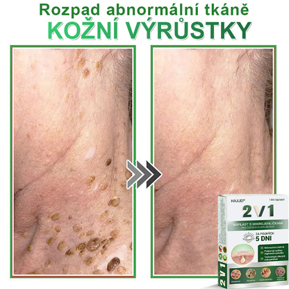 HAJUEI® 📌 𝟐𝐯𝟏 𝐡𝐲𝐝𝐫𝐨𝐤𝐨𝐥𝐨𝐢𝐝𝐧í 𝐧á𝐩𝐥𝐚𝐬𝐭𝐢 𝐬 𝐦𝐢𝐤𝐫𝐨𝐣𝐞𝐡𝐥𝐢č𝐤𝐚𝐦𝐢 | 𝐒𝐩𝐞𝐜𝐢á𝐥𝐧ě 𝐯𝐲𝐯𝐢𝐧𝐮𝐭é 𝐩𝐫𝐨 𝐨𝐝𝐬𝐭𝐫𝐚𝐧ě𝐧í 𝐯𝐲𝐬𝐭𝐨𝐮𝐩𝐥ý𝐜𝐡 𝐦𝐚𝐭𝐞ř𝐬𝐤ý𝐜𝐡 𝐳𝐧𝐚𝐦é𝐧𝐞𝐤, 𝐚𝐤𝐧é, 𝐩𝐥𝐨𝐜𝐡ý𝐜𝐡 𝐛𝐫𝐚𝐝𝐚𝐯𝐢𝐜 𝐚 𝐤𝐨ž𝐧í𝐜𝐡 𝐯ý𝐫ů𝐬𝐭𝐤ů | 𝐁𝐚𝐥𝐞𝐧í 𝟏𝟒𝟒 𝐤𝐮𝐬ů🌵🌵