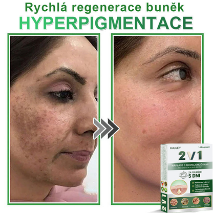 HAJUEI® 📌 𝟐𝐯𝟏 𝐡𝐲𝐝𝐫𝐨𝐤𝐨𝐥𝐨𝐢𝐝𝐧í 𝐧á𝐩𝐥𝐚𝐬𝐭𝐢 𝐬 𝐦𝐢𝐤𝐫𝐨𝐣𝐞𝐡𝐥𝐢č𝐤𝐚𝐦𝐢 | 𝐒𝐩𝐞𝐜𝐢á𝐥𝐧ě 𝐯𝐲𝐯𝐢𝐧𝐮𝐭é 𝐩𝐫𝐨 𝐨𝐝𝐬𝐭𝐫𝐚𝐧ě𝐧í 𝐯𝐲𝐬𝐭𝐨𝐮𝐩𝐥ý𝐜𝐡 𝐦𝐚𝐭𝐞ř𝐬𝐤ý𝐜𝐡 𝐳𝐧𝐚𝐦é𝐧𝐞𝐤, 𝐚𝐤𝐧é, 𝐩𝐥𝐨𝐜𝐡ý𝐜𝐡 𝐛𝐫𝐚𝐝𝐚𝐯𝐢𝐜 𝐚 𝐤𝐨ž𝐧í𝐜𝐡 𝐯ý𝐫ů𝐬𝐭𝐤ů | 𝐁𝐚𝐥𝐞𝐧í 𝟏𝟒𝟒 𝐤𝐮𝐬ů🌵🌵
