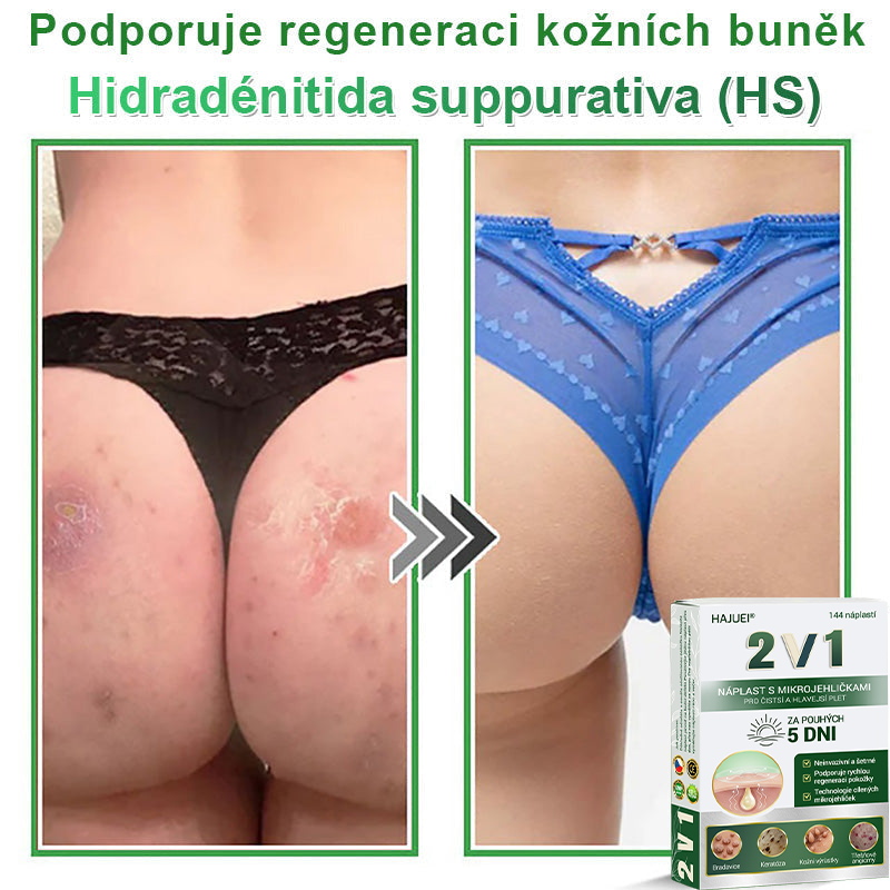 HAJUEI® 📌 𝟐𝐯𝟏 𝐡𝐲𝐝𝐫𝐨𝐤𝐨𝐥𝐨𝐢𝐝𝐧í 𝐧á𝐩𝐥𝐚𝐬𝐭𝐢 𝐬 𝐦𝐢𝐤𝐫𝐨𝐣𝐞𝐡𝐥𝐢č𝐤𝐚𝐦𝐢 | 𝐒𝐩𝐞𝐜𝐢á𝐥𝐧ě 𝐯𝐲𝐯𝐢𝐧𝐮𝐭é 𝐩𝐫𝐨 𝐨𝐝𝐬𝐭𝐫𝐚𝐧ě𝐧í 𝐯𝐲𝐬𝐭𝐨𝐮𝐩𝐥ý𝐜𝐡 𝐦𝐚𝐭𝐞ř𝐬𝐤ý𝐜𝐡 𝐳𝐧𝐚𝐦é𝐧𝐞𝐤, 𝐚𝐤𝐧é, 𝐩𝐥𝐨𝐜𝐡ý𝐜𝐡 𝐛𝐫𝐚𝐝𝐚𝐯𝐢𝐜 𝐚 𝐤𝐨ž𝐧í𝐜𝐡 𝐯ý𝐫ů𝐬𝐭𝐤ů | 𝐁𝐚𝐥𝐞𝐧í 𝟏𝟒𝟒 𝐤𝐮𝐬ů🌵🌵