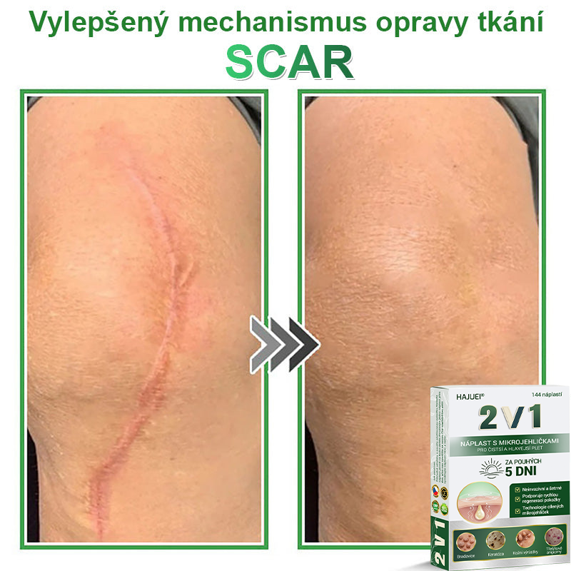 HAJUEI® 📌 𝟐𝐯𝟏 𝐡𝐲𝐝𝐫𝐨𝐤𝐨𝐥𝐨𝐢𝐝𝐧í 𝐧á𝐩𝐥𝐚𝐬𝐭𝐢 𝐬 𝐦𝐢𝐤𝐫𝐨𝐣𝐞𝐡𝐥𝐢č𝐤𝐚𝐦𝐢 | 𝐒𝐩𝐞𝐜𝐢á𝐥𝐧ě 𝐯𝐲𝐯𝐢𝐧𝐮𝐭é 𝐩𝐫𝐨 𝐨𝐝𝐬𝐭𝐫𝐚𝐧ě𝐧í 𝐯𝐲𝐬𝐭𝐨𝐮𝐩𝐥ý𝐜𝐡 𝐦𝐚𝐭𝐞ř𝐬𝐤ý𝐜𝐡 𝐳𝐧𝐚𝐦é𝐧𝐞𝐤, 𝐚𝐤𝐧é, 𝐩𝐥𝐨𝐜𝐡ý𝐜𝐡 𝐛𝐫𝐚𝐝𝐚𝐯𝐢𝐜 𝐚 𝐤𝐨ž𝐧í𝐜𝐡 𝐯ý𝐫ů𝐬𝐭𝐤ů | 𝐁𝐚𝐥𝐞𝐧í 𝟏𝟒𝟒 𝐤𝐮𝐬ů🌵🌵