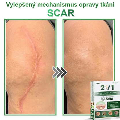 HAJUEI® 📌 𝟐𝐯𝟏 𝐡𝐲𝐝𝐫𝐨𝐤𝐨𝐥𝐨𝐢𝐝𝐧í 𝐧á𝐩𝐥𝐚𝐬𝐭𝐢 𝐬 𝐦𝐢𝐤𝐫𝐨𝐣𝐞𝐡𝐥𝐢č𝐤𝐚𝐦𝐢 | 𝐒𝐩𝐞𝐜𝐢á𝐥𝐧ě 𝐯𝐲𝐯𝐢𝐧𝐮𝐭é 𝐩𝐫𝐨 𝐨𝐝𝐬𝐭𝐫𝐚𝐧ě𝐧í 𝐯𝐲𝐬𝐭𝐨𝐮𝐩𝐥ý𝐜𝐡 𝐦𝐚𝐭𝐞ř𝐬𝐤ý𝐜𝐡 𝐳𝐧𝐚𝐦é𝐧𝐞𝐤, 𝐚𝐤𝐧é, 𝐩𝐥𝐨𝐜𝐡ý𝐜𝐡 𝐛𝐫𝐚𝐝𝐚𝐯𝐢𝐜 𝐚 𝐤𝐨ž𝐧í𝐜𝐡 𝐯ý𝐫ů𝐬𝐭𝐤ů | 𝐁𝐚𝐥𝐞𝐧í 𝟏𝟒𝟒 𝐤𝐮𝐬ů🌵🌵