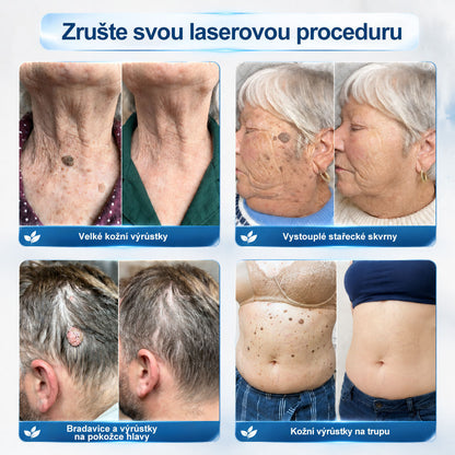 🎁 Počkejte! Přidejte si ještě jeden Hiskin® rollerball se slevou 50 %