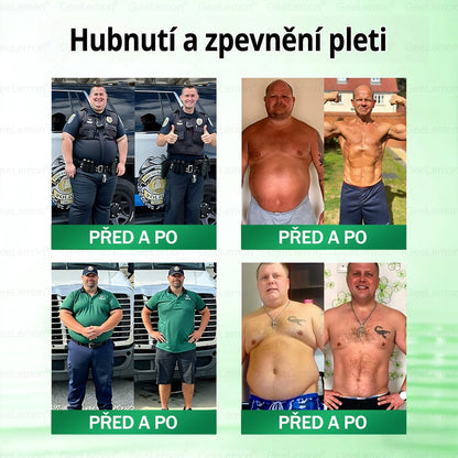 Oficiální český obchod | 👩‍⚕️ 𝐆𝐞𝐞𝐋𝐞𝐦𝐨𝐧® 8v1 Nanomikrojehlicové náplasti na formování těla 🇨🇿 Pouze 1 použití denně ✅ Výsledky viditelné již za 7 dní – vhodné pro obezitu, kardiovaskulární zdraví, cukrovku a problémy s klouby.