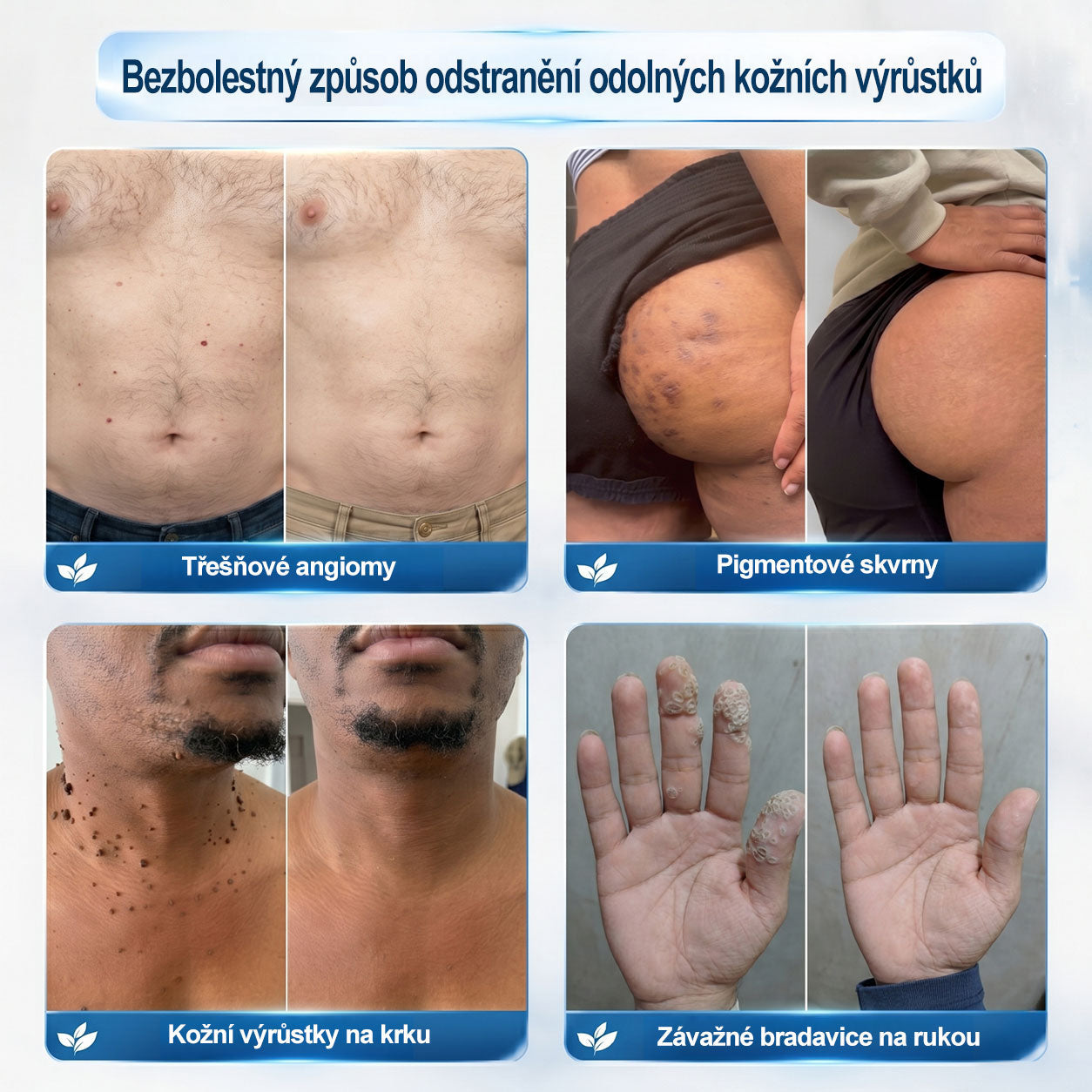 🎁 Počkejte! Přidejte si ještě jeden Hiskin® rollerball se slevou 50 %