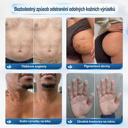 🎁 Počkejte! Přidejte si ještě jeden Hiskin® rollerball se slevou 50 %