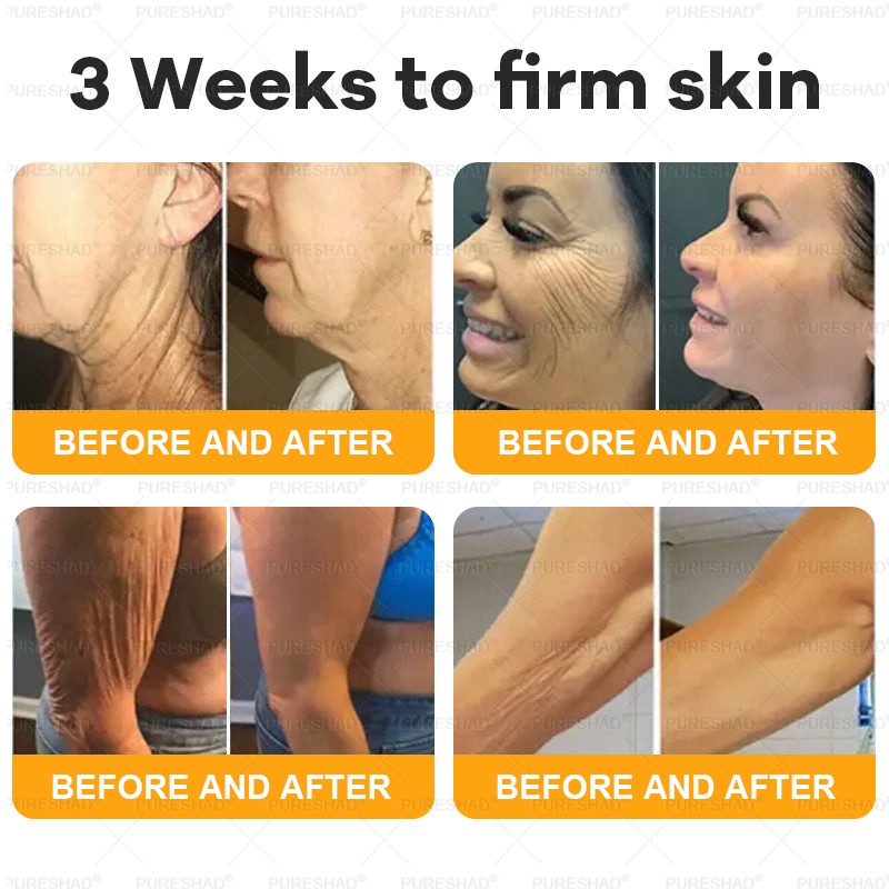 𝐌𝐚𝐝𝐞 𝐚𝐧𝐝 𝐒𝐡𝐢𝐩𝐩𝐞𝐝 𝐟𝐫𝐨𝐦 𝐔𝐒𝐀 ✨𝗣𝘂𝗿𝗲𝐒𝐡𝐚𝐝𝐞® 𝐍𝐞𝐜𝐤 & 𝐂𝐡𝐞𝐬𝐭 𝐅𝐢𝐫𝐦𝐢𝐧𝐠 𝐀𝐠𝐞 𝐑𝐞𝐧𝐞𝐰 𝐂𝐫𝐞𝐚𝐦