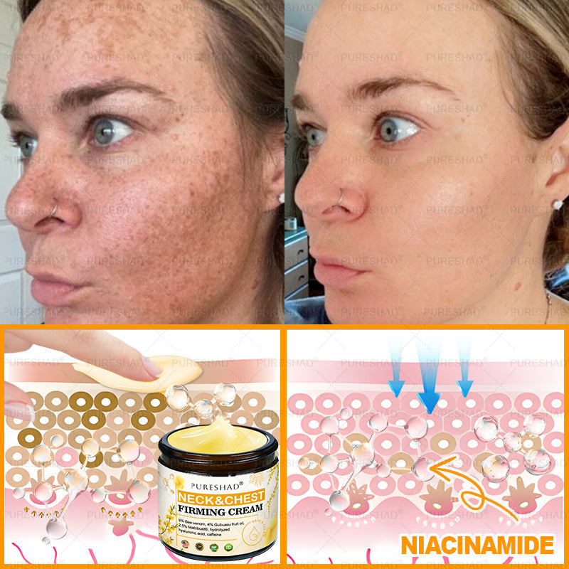𝐌𝐚𝐝𝐞 𝐚𝐧𝐝 𝐒𝐡𝐢𝐩𝐩𝐞𝐝 𝐟𝐫𝐨𝐦 𝐔𝐒𝐀 ✨𝗣𝘂𝗿𝗲𝐒𝐡𝐚𝐝𝐞® 𝐍𝐞𝐜𝐤 & 𝐂𝐡𝐞𝐬𝐭 𝐅𝐢𝐫𝐦𝐢𝐧𝐠 𝐀𝐠𝐞 𝐑𝐞𝐧𝐞𝐰 𝐂𝐫𝐞𝐚𝐦